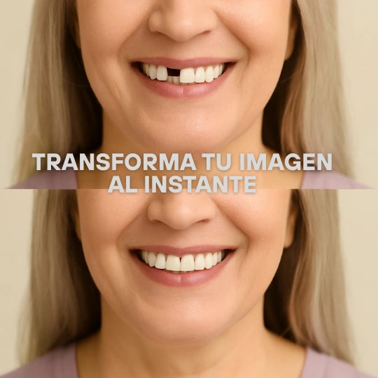 Diente Temporal – Reemplazo Instantáneo – Recupera Tu Sonrisa al Instante Sin Dentista